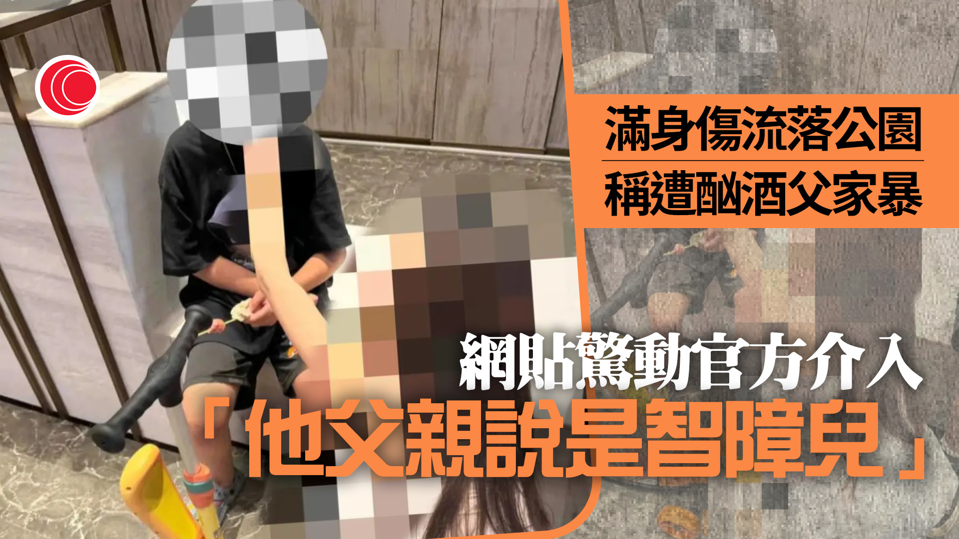 男童稱遭家暴拒回家　父辯稱「風扇削頭變智障」　爆料者：出軌再婚想棄養