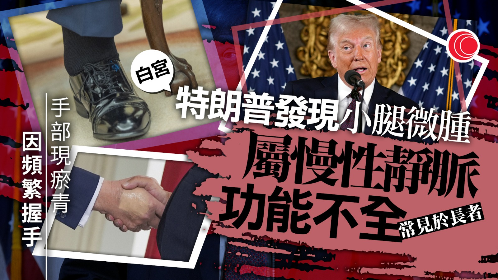 白宮回應特朗普腳腫手瘀　指其健康狀況良好　