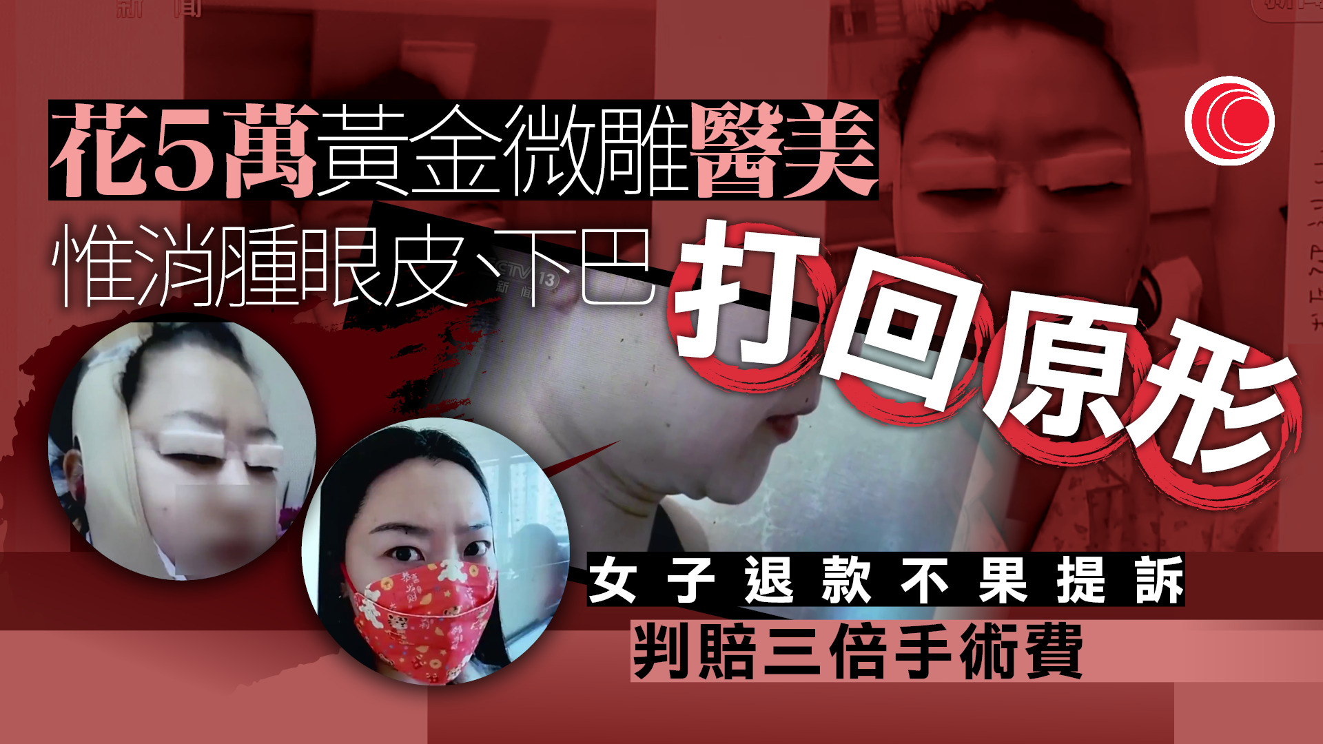 內地有人花費數萬元「美容」變「毀容」　專家提醒提防「醫美陷阱」