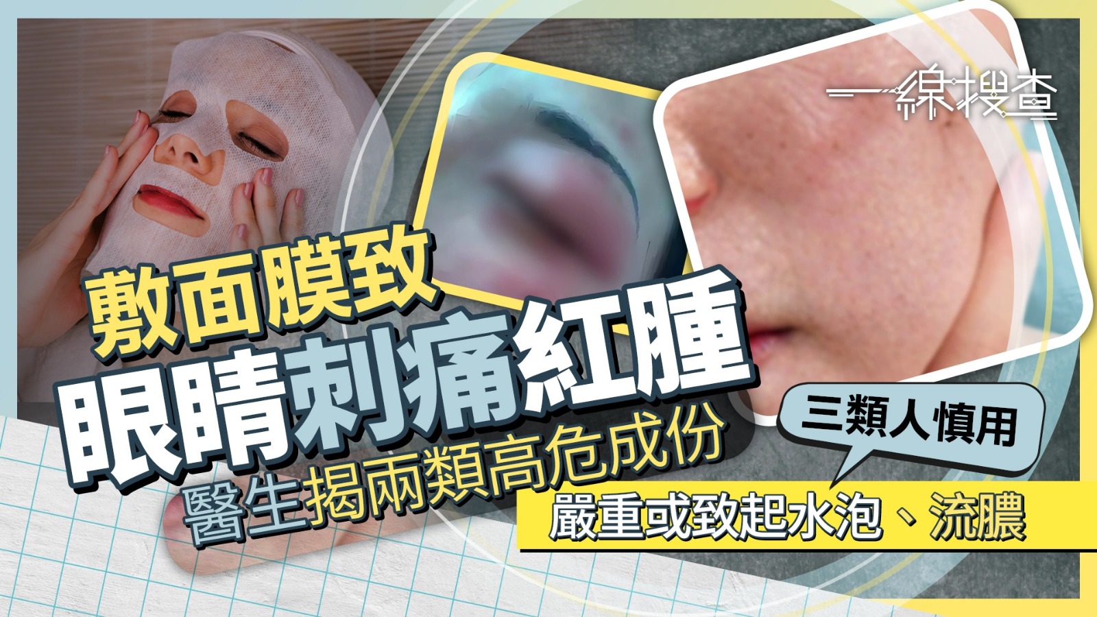 一線搜查｜面膜護膚變傷眼？　醫生警告兩類成份易致敏　三招避風險