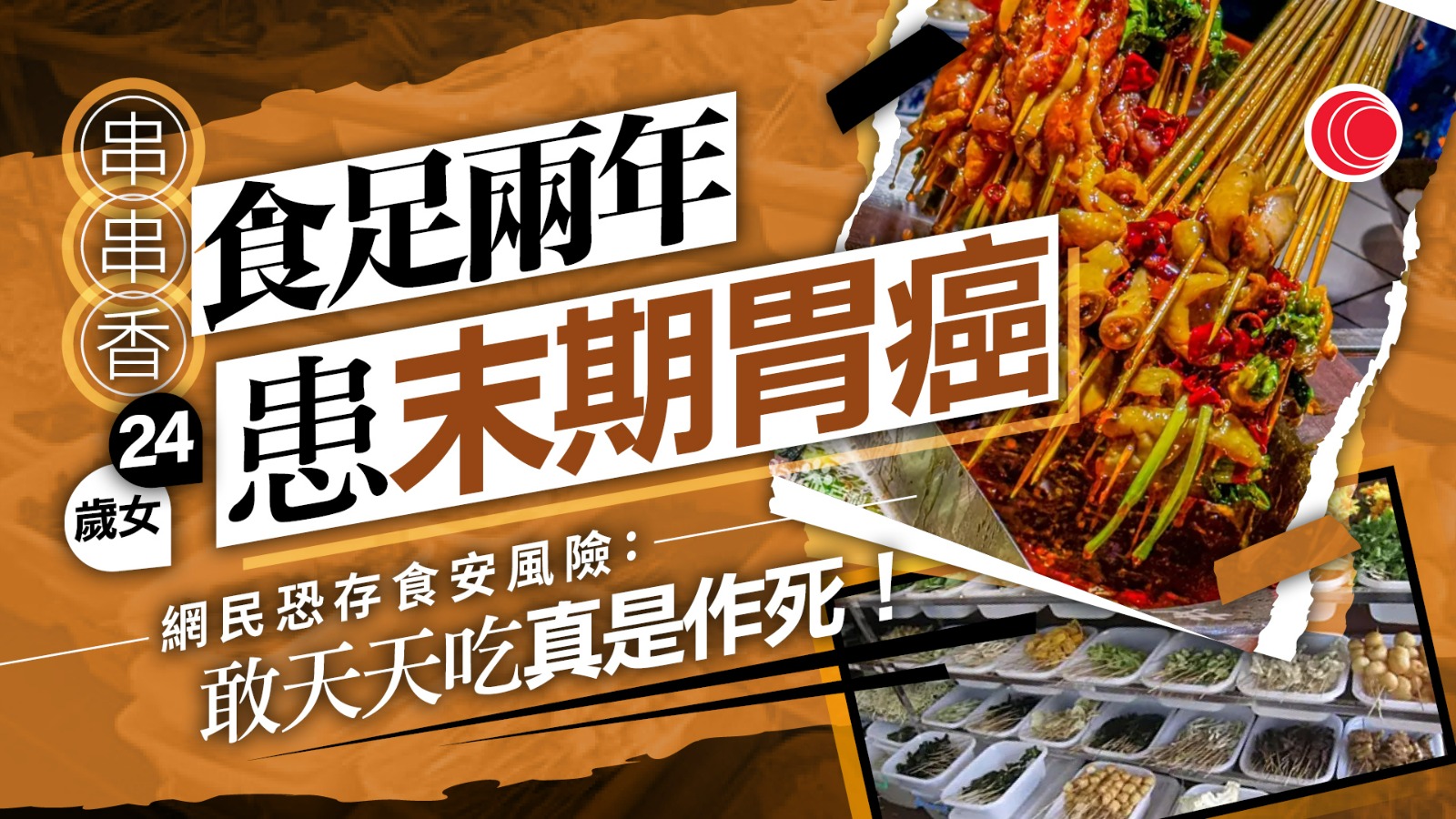 拒食正餐、鍾情「地攤串串」　女大學生食足兩年「勁削胃」　剛畢業確診胃癌末期