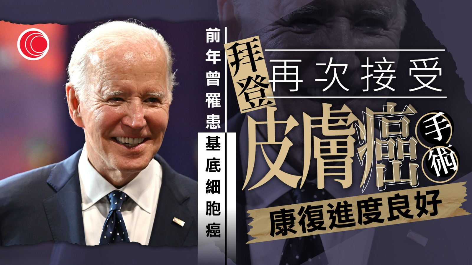 拜登再次接受皮膚癌手術