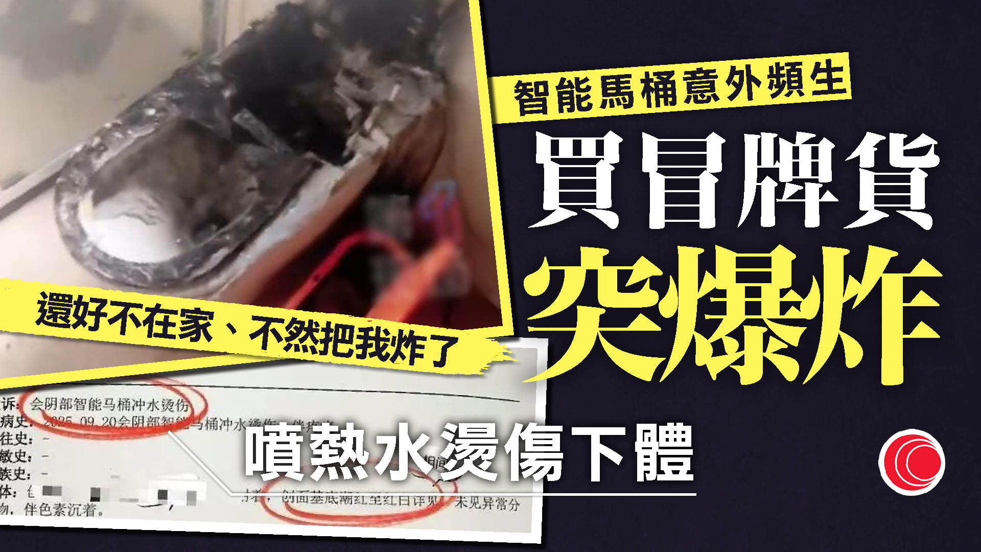 網購智能馬桶接連出事？　戶主離家後突然爆炸　有女苦主「陰部深二度燙傷」