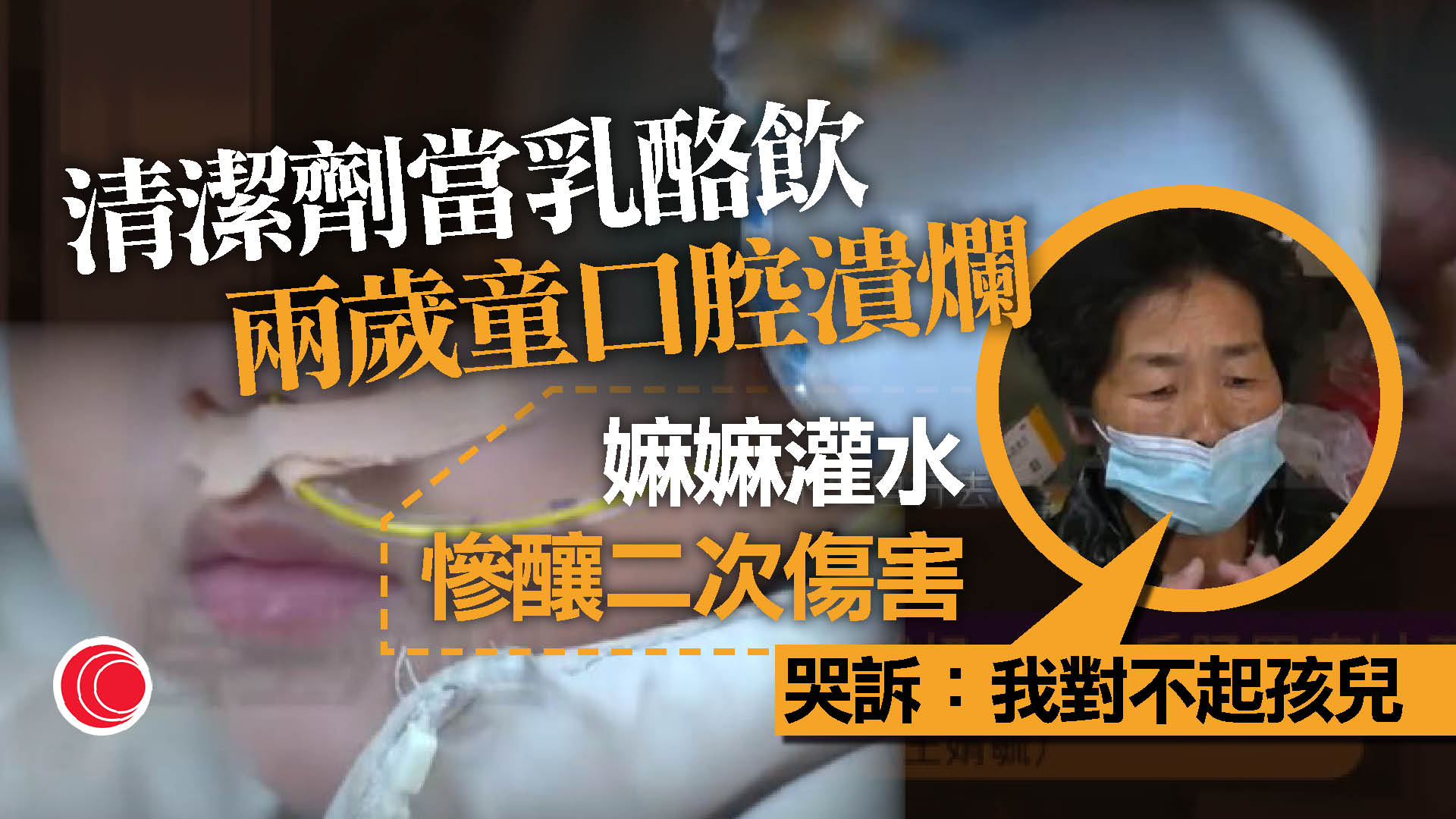 兩歲童誤服清潔劑　祖母「灌水洗胃」反致大出血　媽媽：裡面肉爛得不成樣