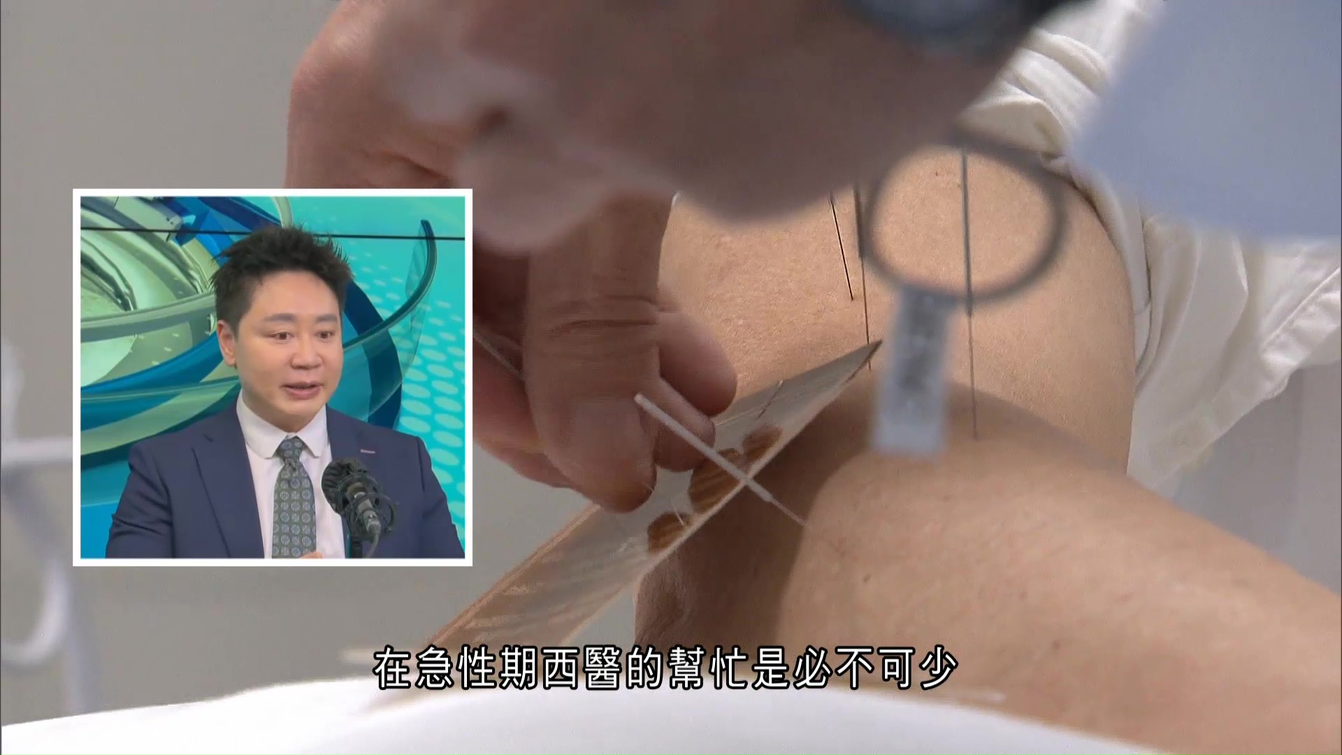 中醫藥發展藍圖｜加強中西醫、跨機構間協作　鍾志豪：未來考慮推中醫慢病共治計劃