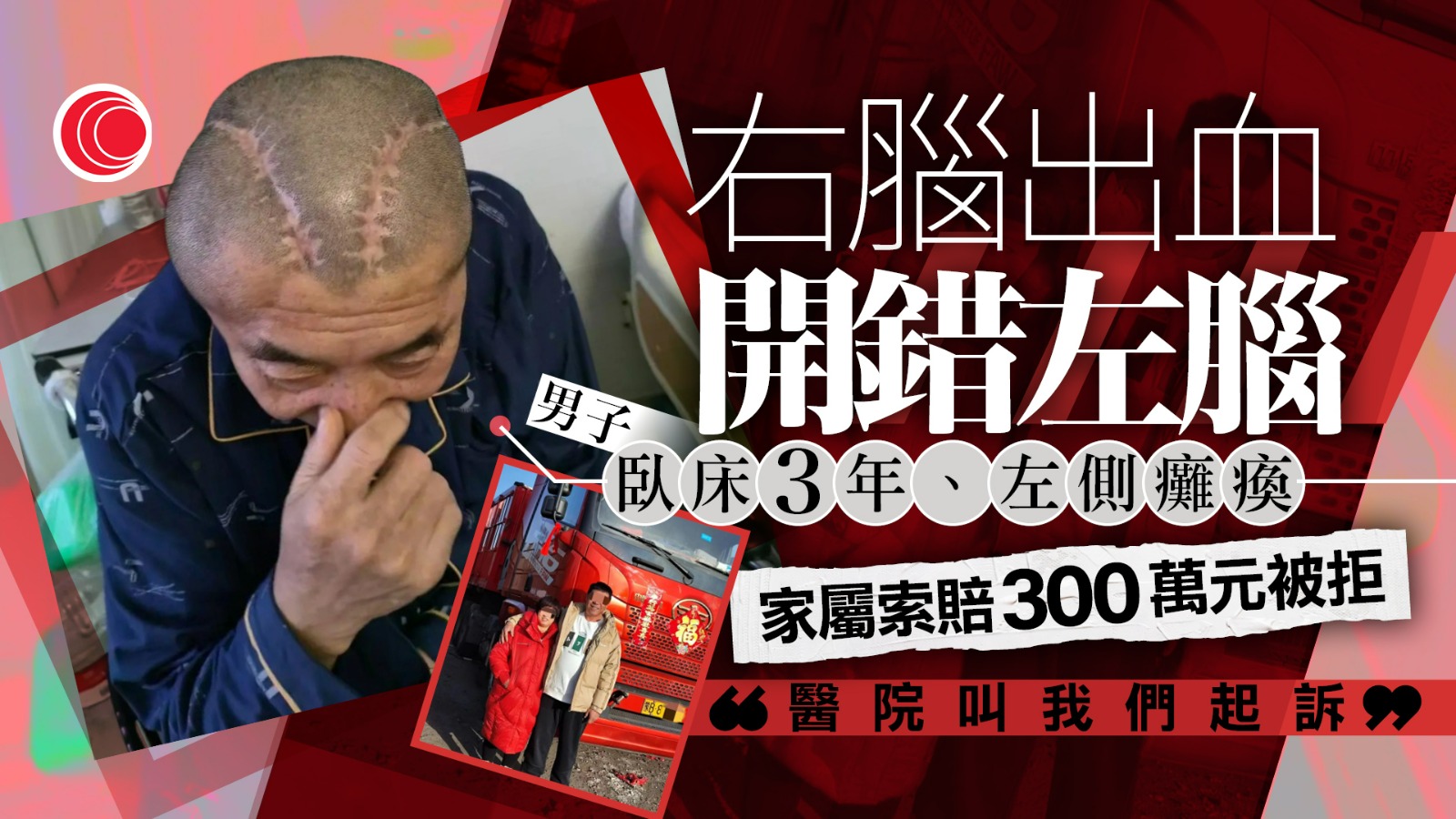 男子右腦出血急做手術　醫生誤開左腦致左肢癱瘓、聽力受損　家屬索賠300萬元被拒