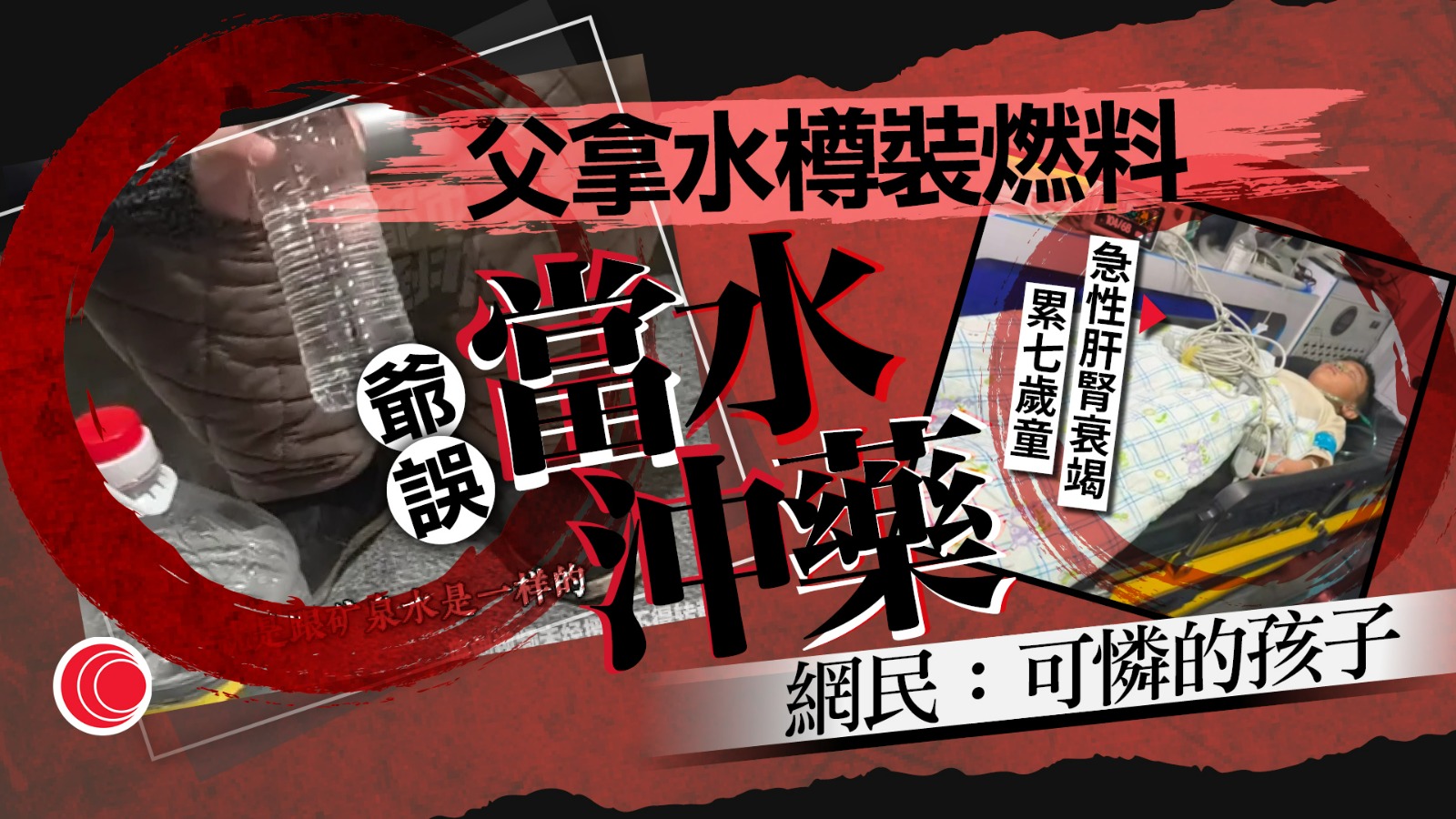 火鍋燃料誤當水沖藥　七歲童中毒腎狂出血　爺父崩潰認責、網民怒轟靠害