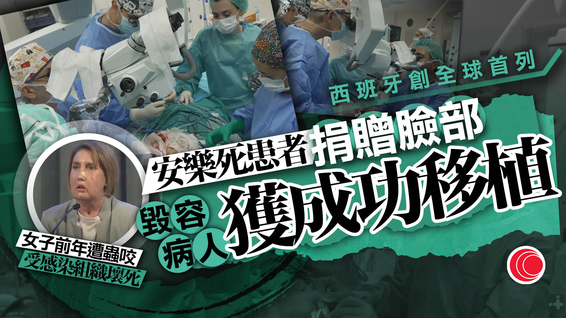 西班牙醫院完成「換臉手術」　創安樂死人士捐臉首例