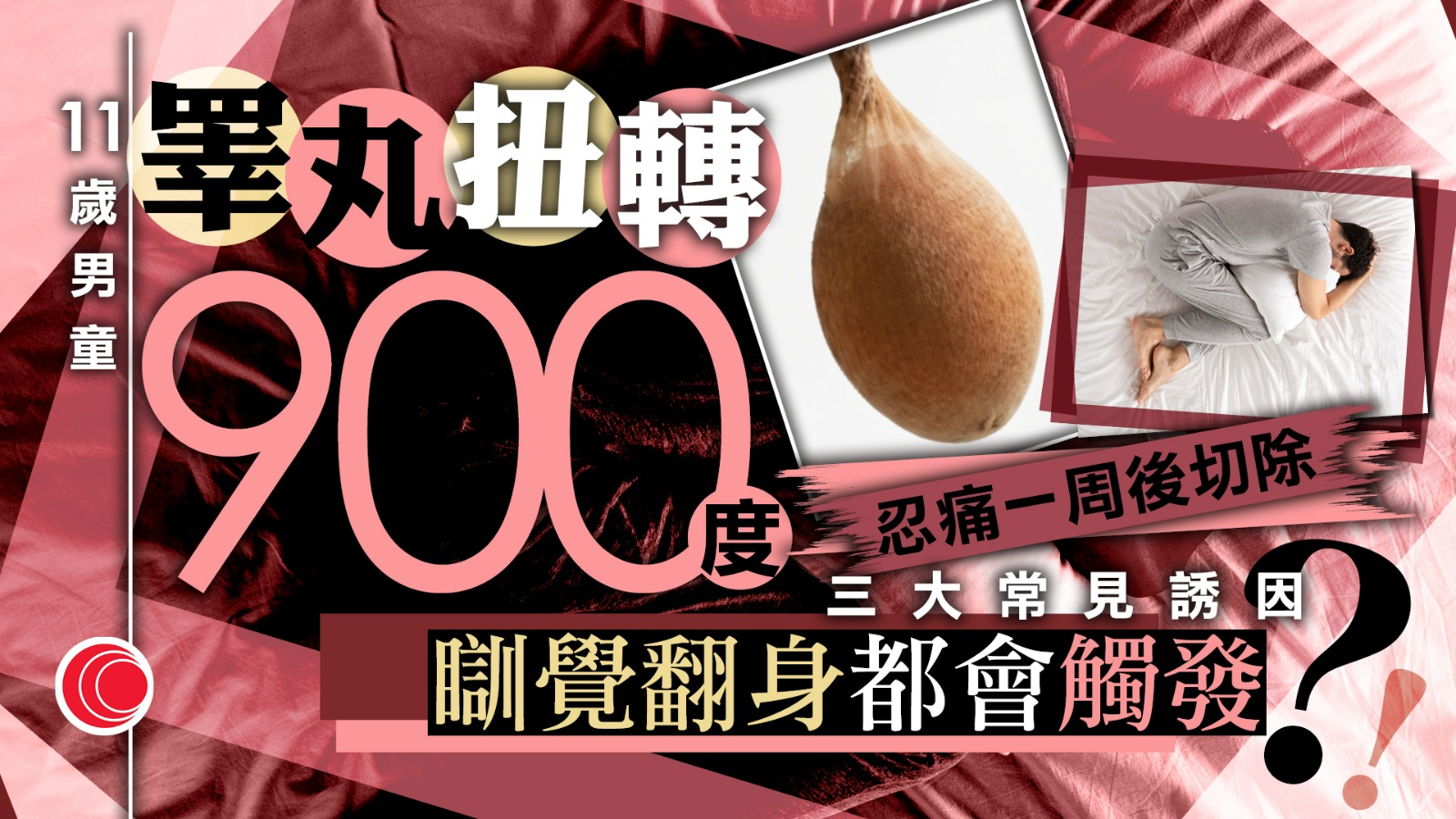 11歲男童下體痛一周　揭睾丸扭轉900度　錯失黃金時間被迫切除