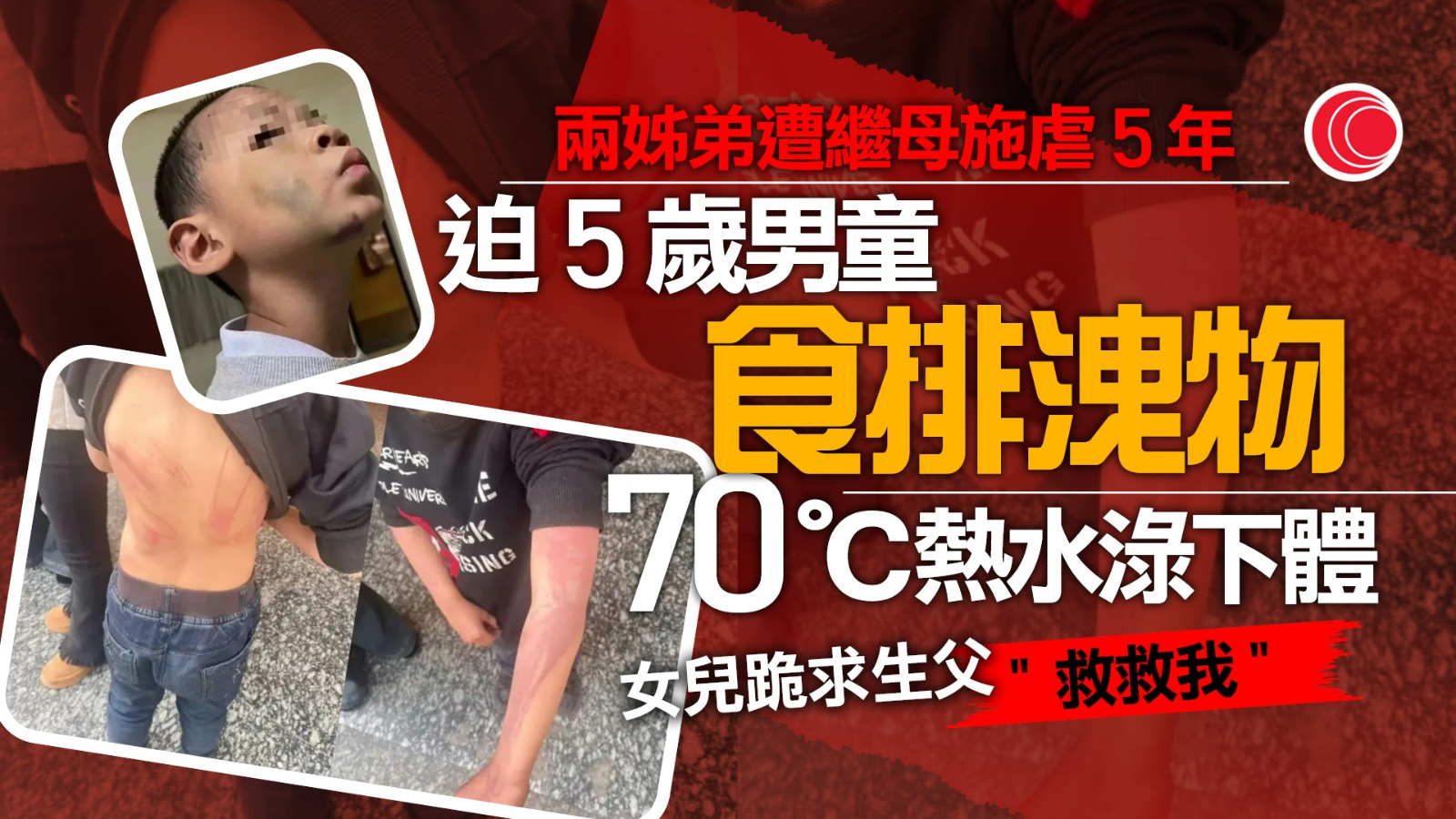 兩姊弟遭繼母長期施虐　被迫食排洩物、高溫熱水沖下體　生父警告老師：勿多管閒事