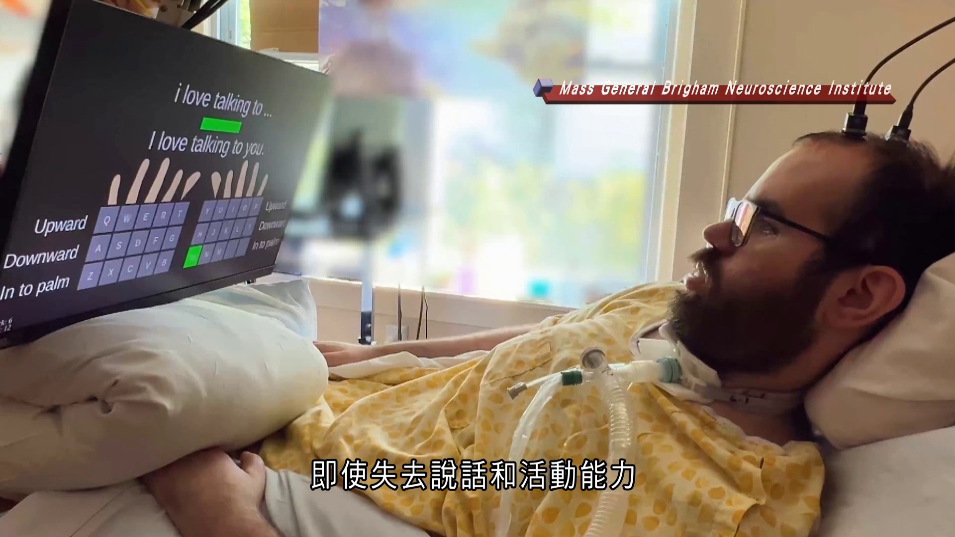 世界轉一圈｜美大學研發新型腦機介面　助漸凍人及癱瘓患者憑「意念」打字助溝通