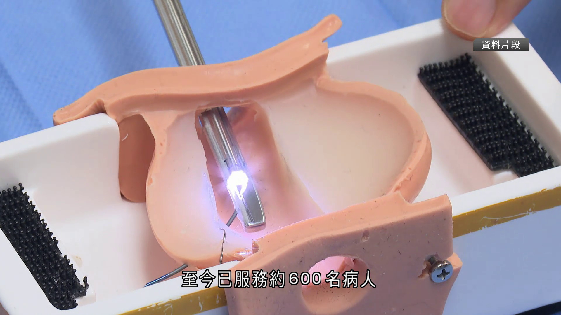 新界東聯網前列腺微創手術時段7月起增至四個　醫生冀降低病人做手術門檻