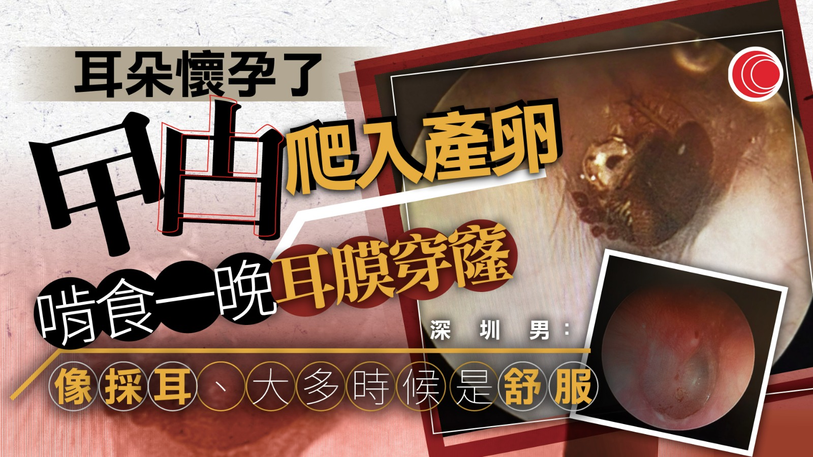 深圳男睡覺遭曱甴爬入耳產卵　咬破耳膜　網民集體崩潰：今年最可怕的影片