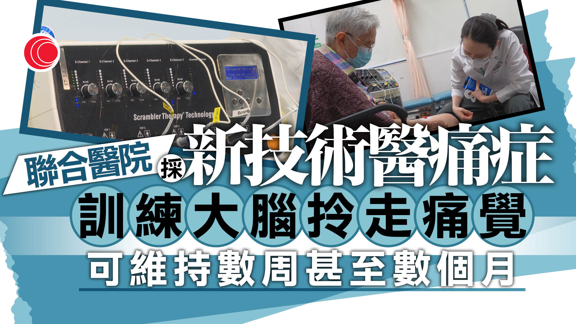 「生蛇」後遺症折磨近十年　81歲婆婆痛不欲生　聯合醫院引非入侵新技術助「大腦去痛」