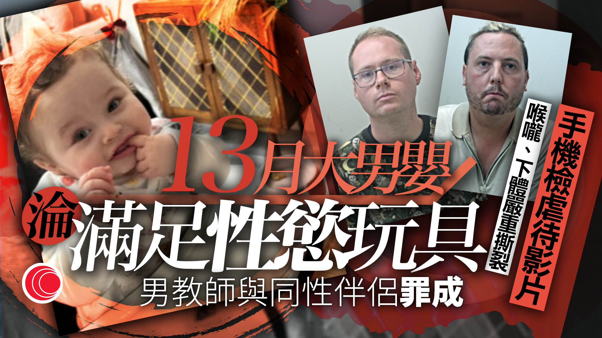 領養後僅4個月慘死　13月男嬰遭男教師夥同性伴侶性侵、虐待　全身40傷