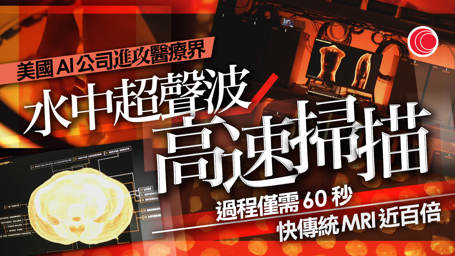 美國AI公司軍醫療界　研水中超聲波掃描　運算比傳統MRI快百倍