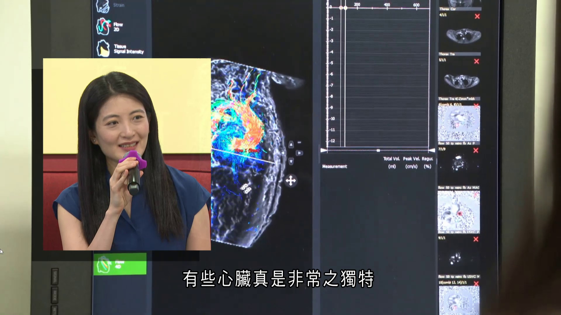 引進創新影像技術　3D模型解構複雜心臟病　兒童醫院醫生獲表彰優秀青年