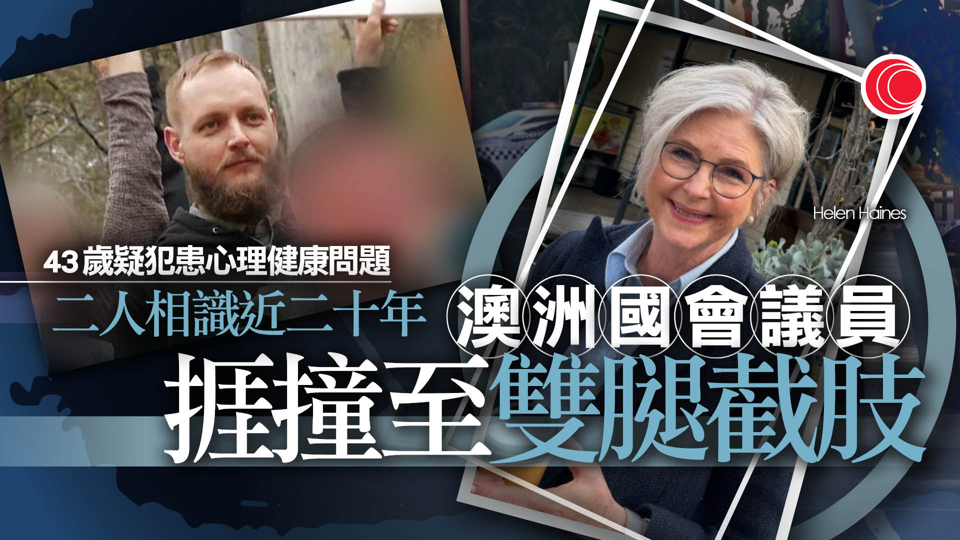 澳洲國會議員遭車撞至雙腳截肢　疑犯被控5罪還柙　當局不排除加控更嚴重罪名